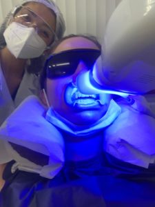 Professional Teeth Whitening