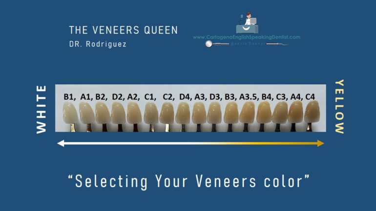 HOW TO SELECT THE RIGHT SHADE? ⋆ VENEERS - CED