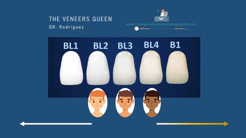 HOW TO SELECT THE RIGHT SHADE? ⋆ VENEERS CED