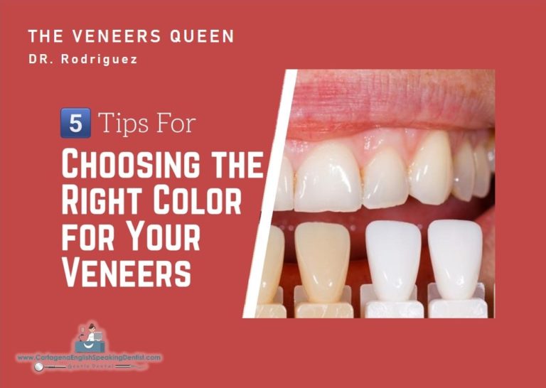 HOW TO SELECT THE RIGHT SHADE? VENEERS CED