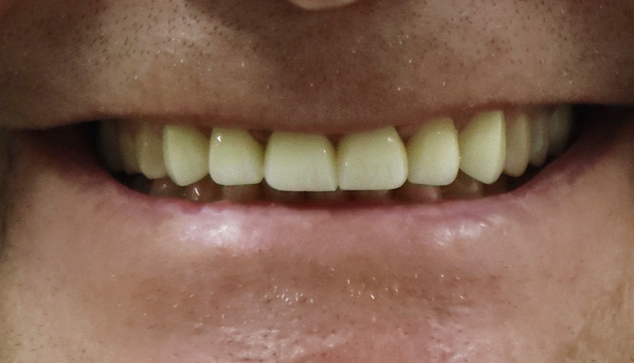 Robert Philips before
