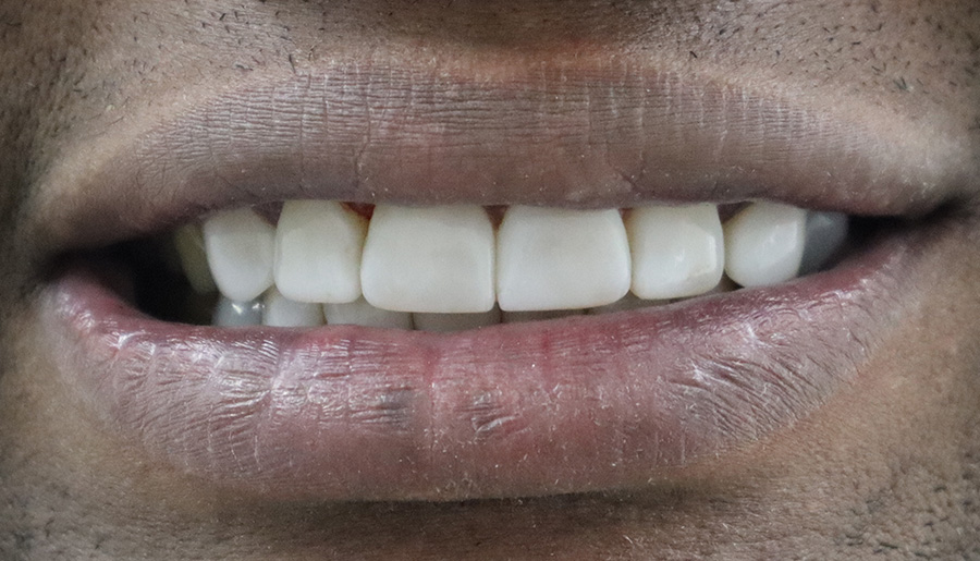Cedrick after