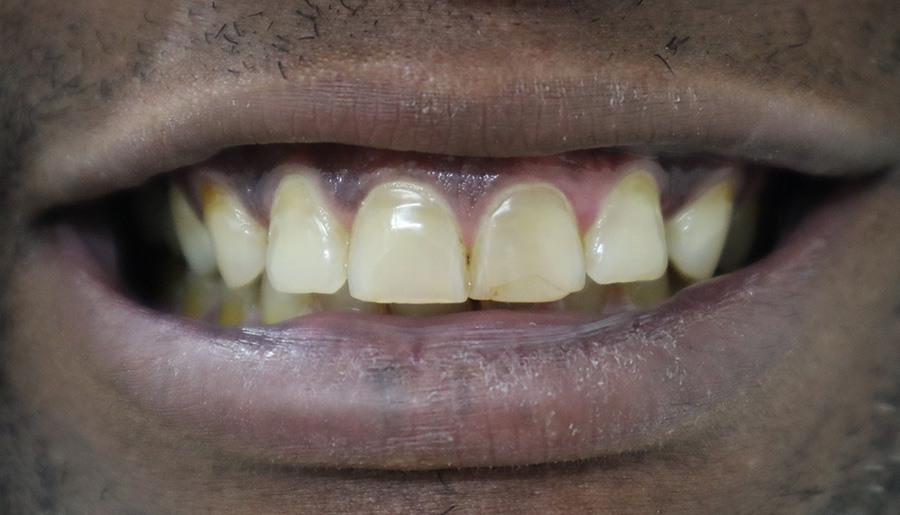 Cedrick before