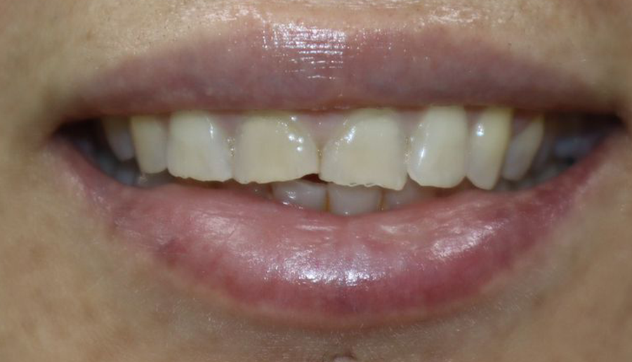 Celicia before