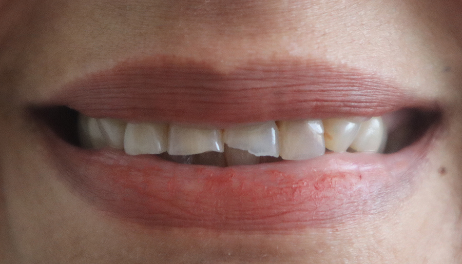 Maria Davila before