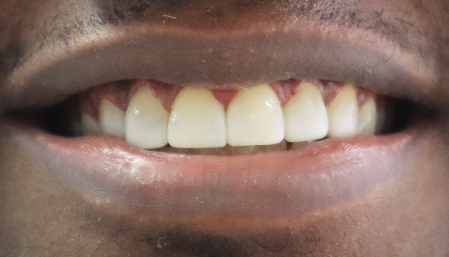 Roman after