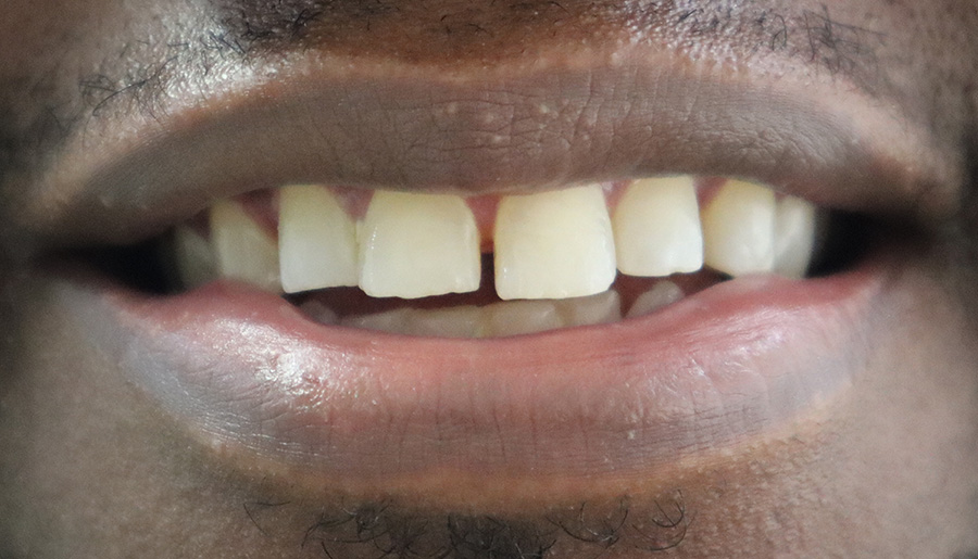 Roman before